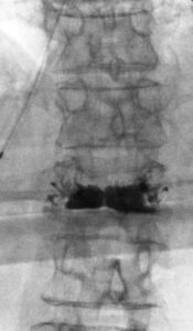 Urban Spine and Joint