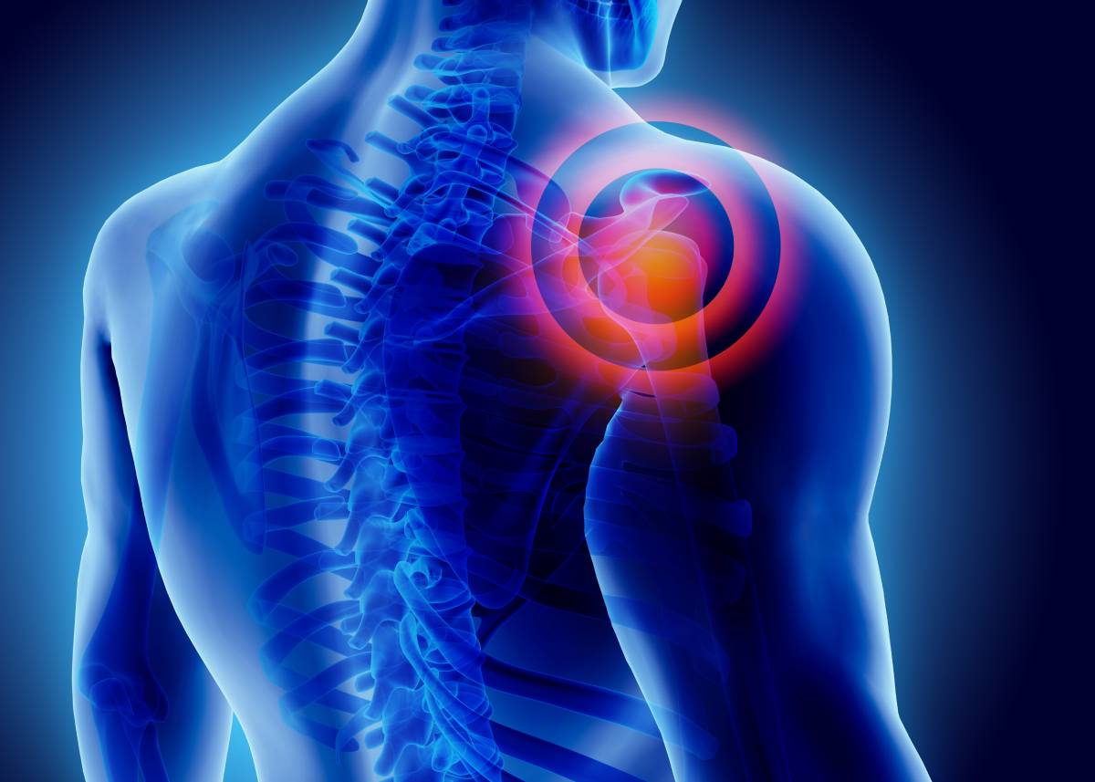 Shoulder pain is a common experience that can range from being a mild nuisance to severely impacting function and quality of life.