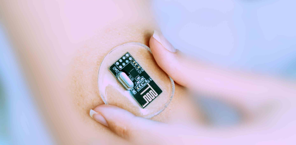 Neuromodulation