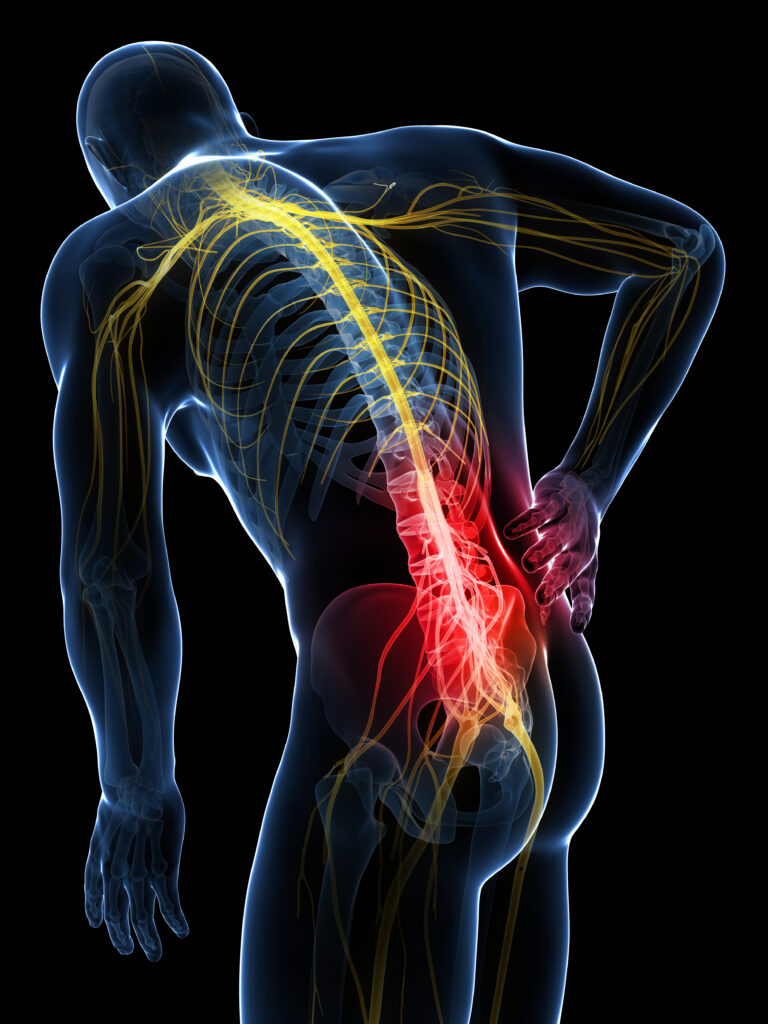 Peripheral nerve stimulation
