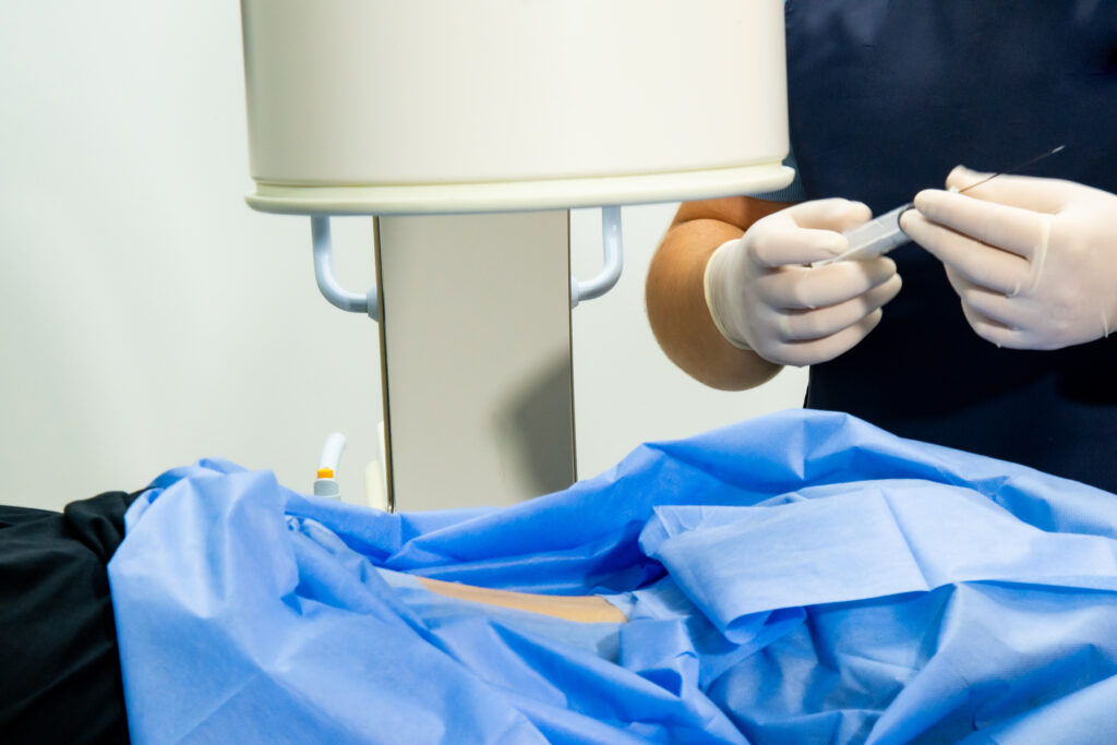Interventional Pain Management