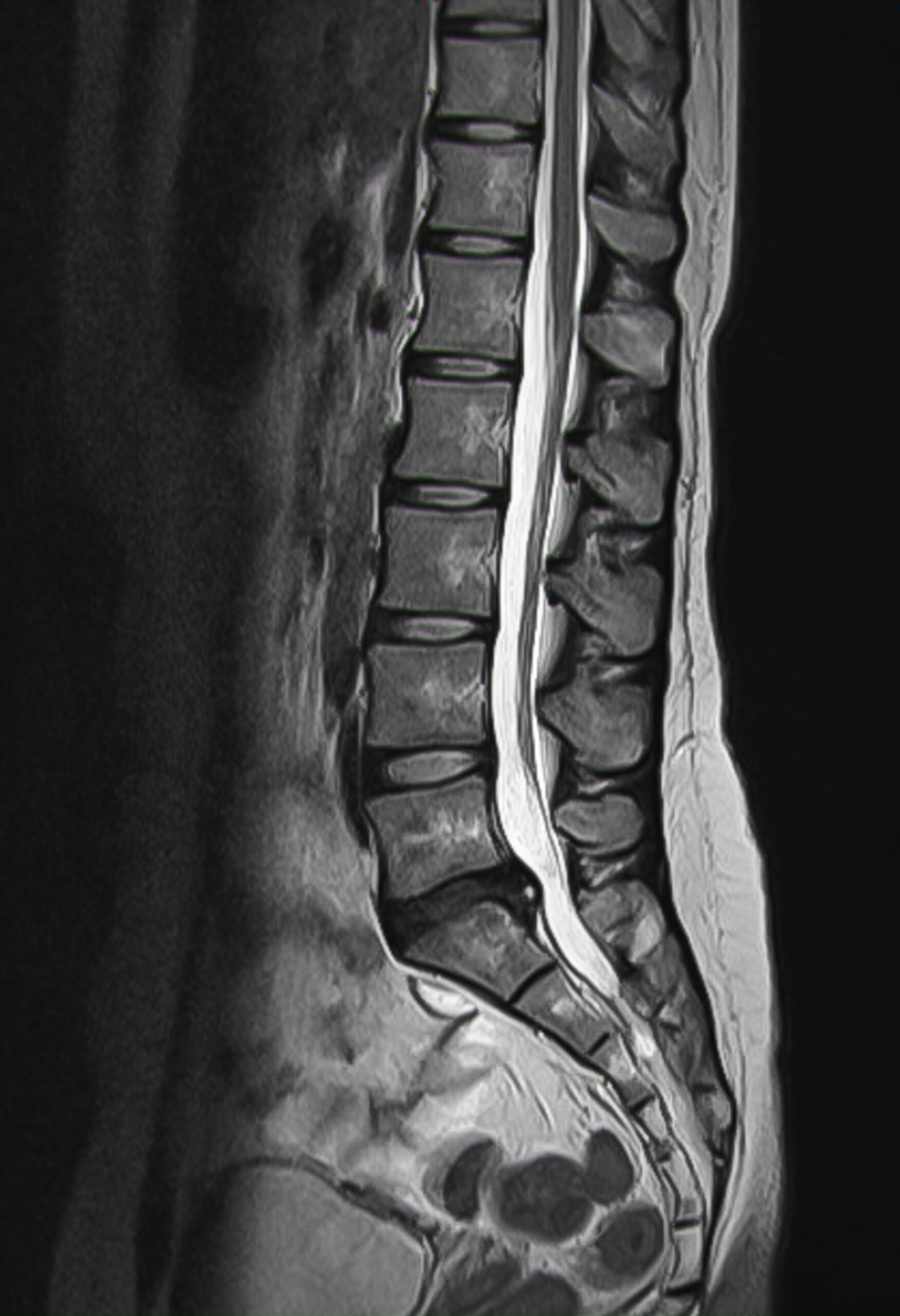 Urban Spine and Joint