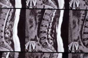 Urban Spine and Joint