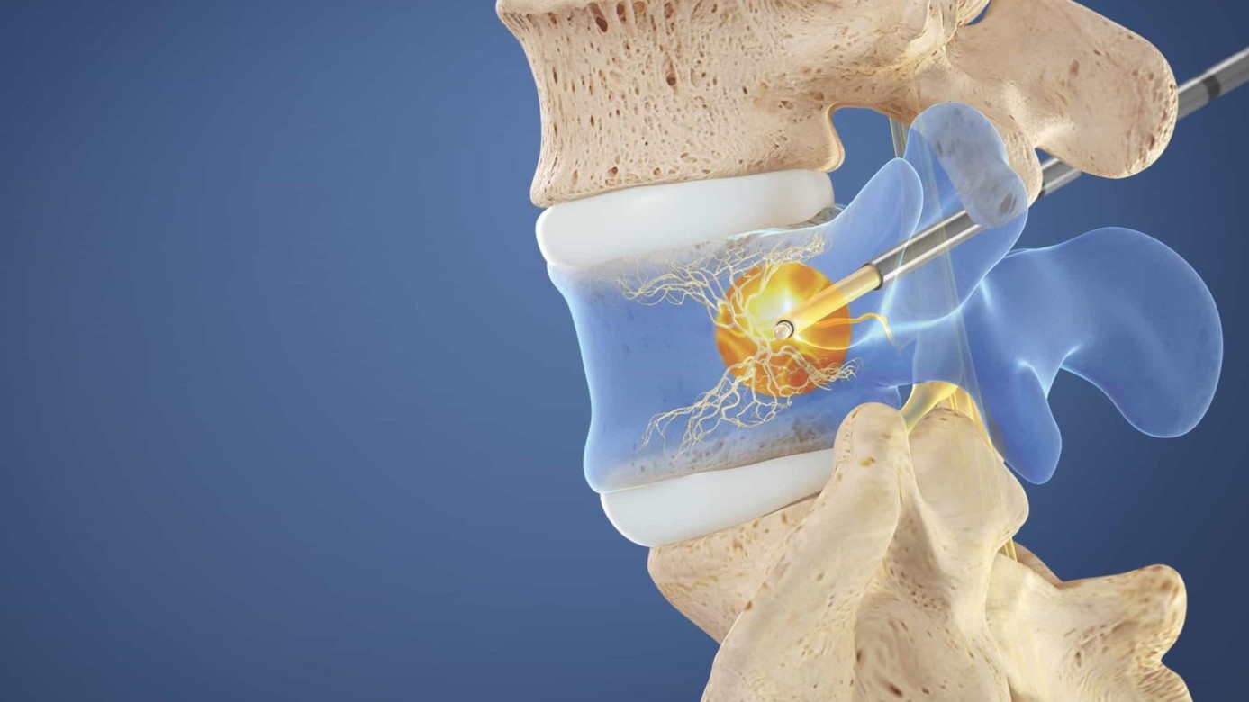 Urban Spine and Joint